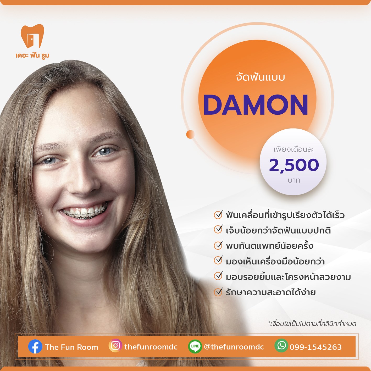 จัดฟันแบบดามอน (Dmon)