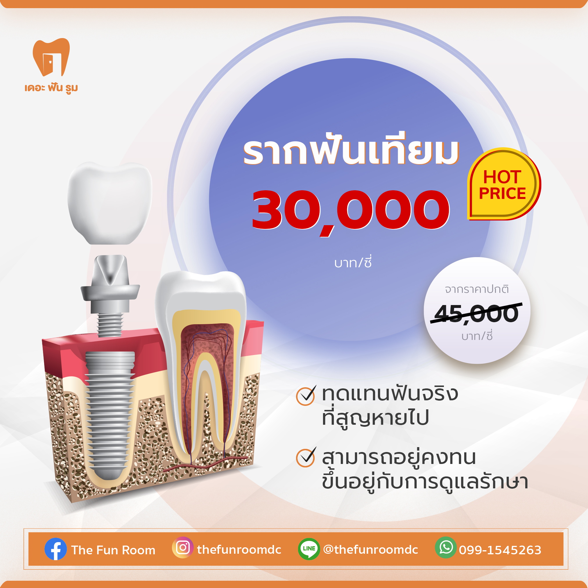 รากฟันเทียม เริ่มต้น 30,000 บาท