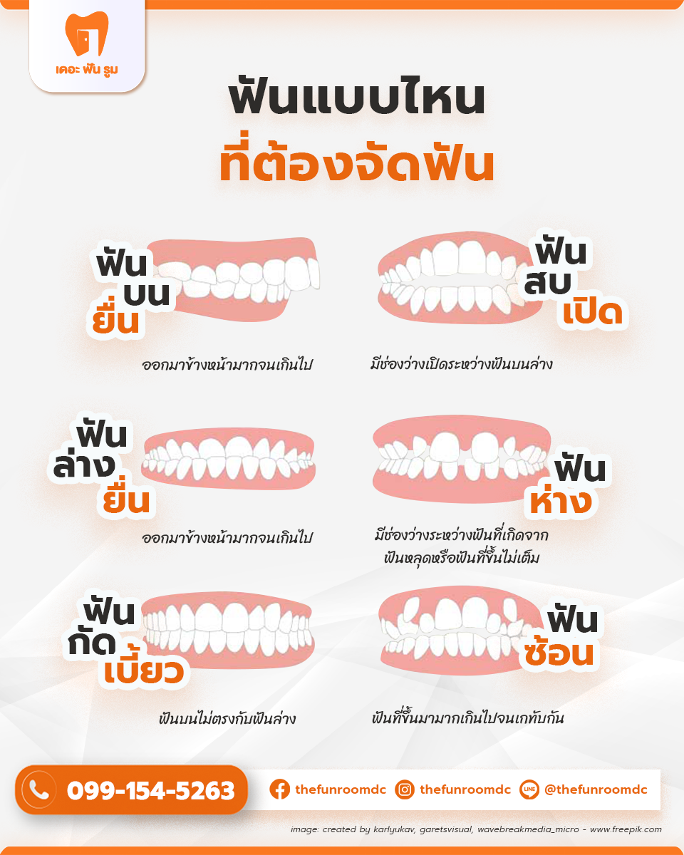 ฟันแบบนี้จัดแบบไหน