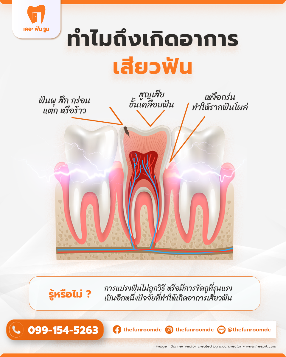 ภาวะเนื้อฟันไวเกิน