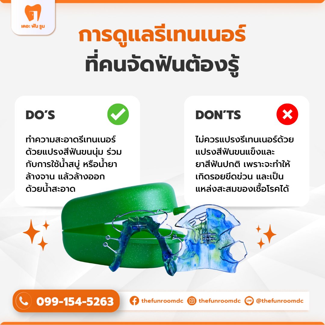 ดูแลรีเทนเนอร์ (Retainer)